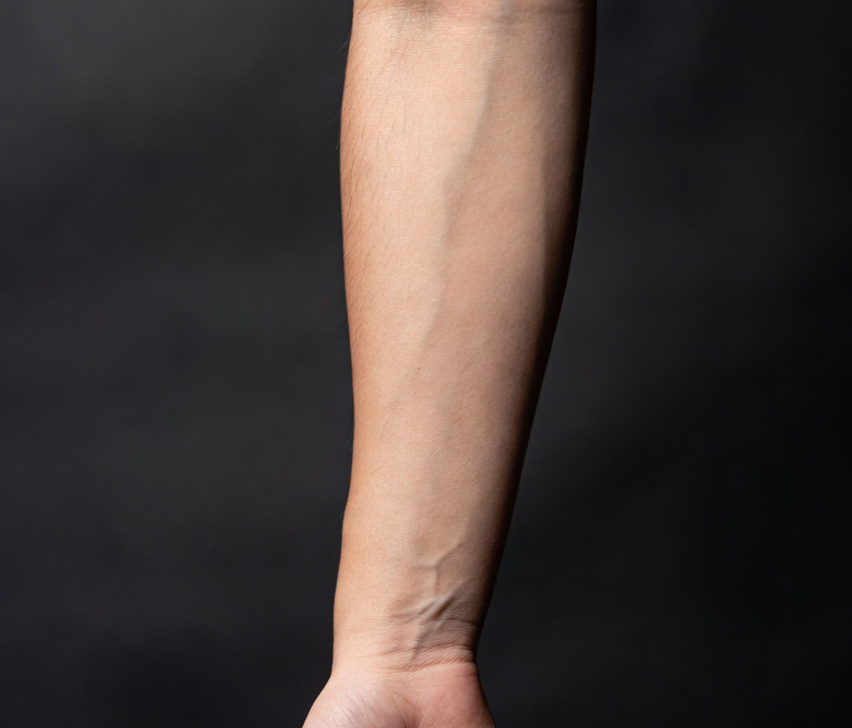 Forearm